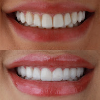 Nive Odontologia