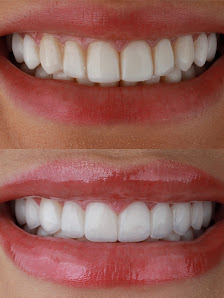Nive Odontologia