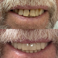Müller & Girardi - Clínica odontológica em Maringá | Implantes | Prótese | Facetas | Canal | Aparelho Dentário