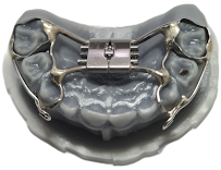 Dr. Lisandro Gonçalves | Dentista Maringá
