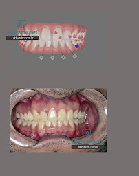 Dr. Lisandro Gonçalves | Dentista Maringá
