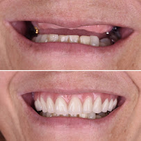 Dr. Leonardo Blanco - Dentista