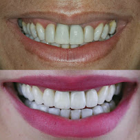 Dr. Leonardo Blanco - Dentista