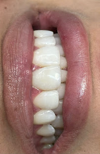 Dr. Leonardo Blanco - Dentista