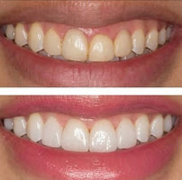 Dr. Arya Edalat - Dentista em Santos