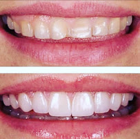 Dr. Arya Edalat - Dentista em Santos