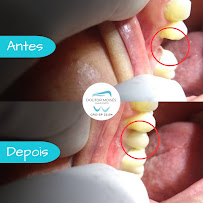 Dr. Moises Chaves Neto - Dentista em Santos