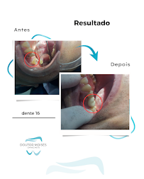 Dr. Moises Chaves Neto - Dentista em Santos