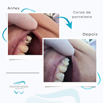 Dr. Moises Chaves Neto - Dentista em Santos