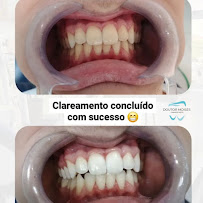 Dr. Moises Chaves Neto - Dentista em Santos