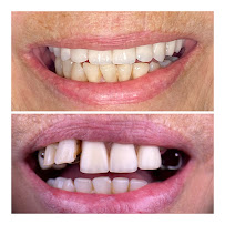 OralCenter Implantes