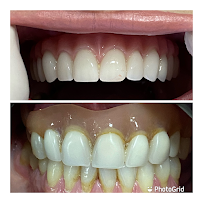 OralCenter Implantes