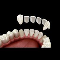 PREDENTE Clínica Odontológica - Implantes Dentários, Próteses, Alinhadores Invisíveis