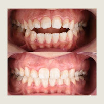 PREDENTE Clínica Odontológica - Implantes Dentários, Próteses, Alinhadores Invisíveis