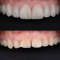 PREDENTE Clínica Odontológica - Implantes Dentários, Próteses, Alinhadores Invisíveis