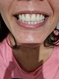 Jana Fiori Odontologia - Lentes de Contato Dentais | Implantes | Alinhadores Invisíveis | Prótese Dentária | Ortodontia