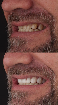 Dentista em Florianópolis - Oral Glass Clínica Odontológica