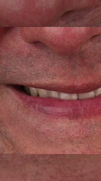 Dentista em Florianópolis - Oral Glass Clínica Odontológica