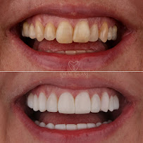 Dentista em Florianópolis - Oral Glass Clínica Odontológica