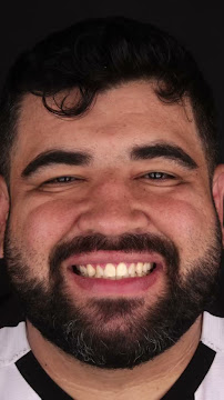 Dentista em Florianópolis - Oral Glass Clínica Odontológica