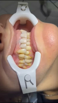 Dentista Florianópolis | COEI Clinica Odontológica