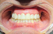 Dentista Florianópolis | COEI Clinica Odontológica