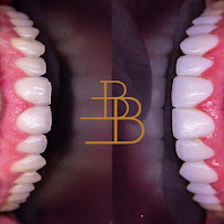 Dr. Beatriz Batista Odontologia | Lentes de Resina
