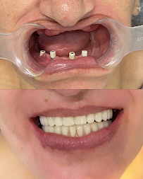Instituto Dr. Ibrahim Jamil | Implantes Dentários e Harmonização Facial | Centro de Florianópolis