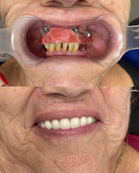 Instituto Dr. Ibrahim Jamil | Implantes Dentários e Harmonização Facial | Centro de Florianópolis