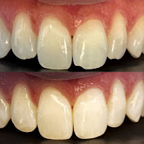 Lemony Odontologia Avançada