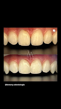 Lemony Odontologia Avançada