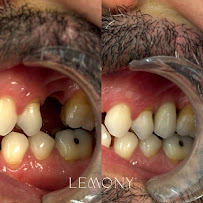 Lemony Odontologia Avançada