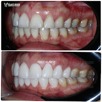 Platinum Dental Group