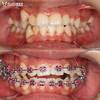 Platinum Dental Group