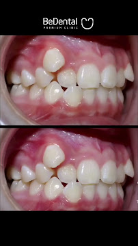 BeDental - PREMIUM CLINIC | Porcelain Veneers & Implants Center