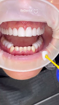 BeDental - PREMIUM CLINIC | Porcelain Veneers & Implants Center