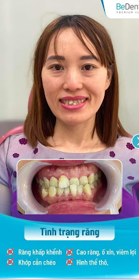 BeDental - PREMIUM CLINIC | Porcelain Veneers & Implants Center