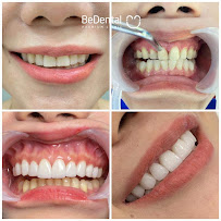 BeDental - PREMIUM CLINIC | Porcelain Veneers & Implants Center