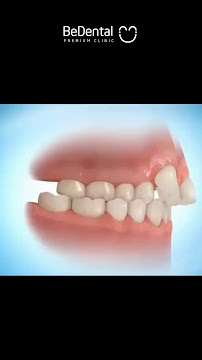 BeDental - PREMIUM CLINIC | Porcelain Veneers & Implants Center