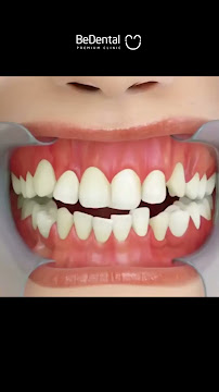 BeDental - PREMIUM CLINIC | Porcelain Veneers & Implants Center