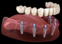 DENTAL ONE Escalon