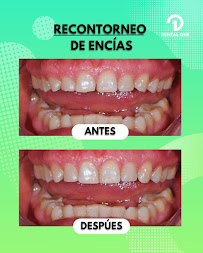 DENTAL ONE Escalon