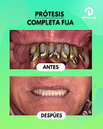 DENTAL ONE Escalon