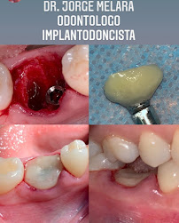 MAXIDENTAL Especialistas Dentales