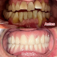 MaxiDental Especialistas Dentales