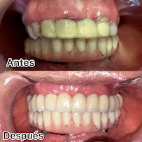 MAXIDENTAL Especialistas Dentales