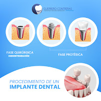 GUERRERO CONTRERAS Dental Group
