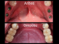 DR. Alex | Implantes Dentales by DENTAL SV