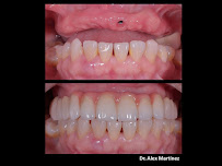 DR. Alex | Implantes Dentales by DENTAL SV