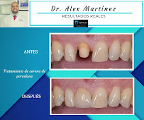 DR. Alex | Implantes Dentales by DENTAL SV